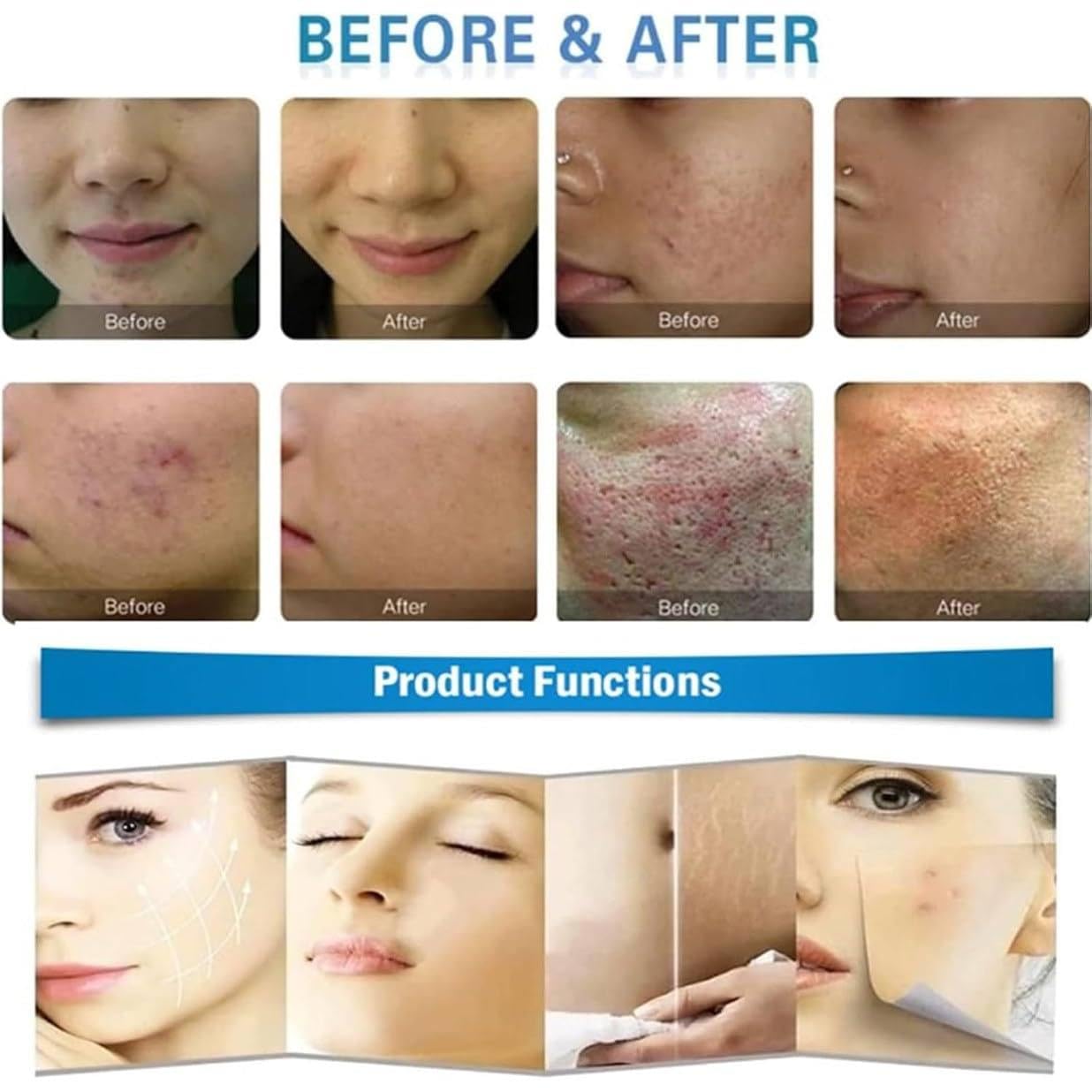 Professionelle fraktionierte Microneedling-Gesichtslifting-Maschine – RF-Hautstraffung, Akne-Reparatur & Hautpflege Beauty Machine