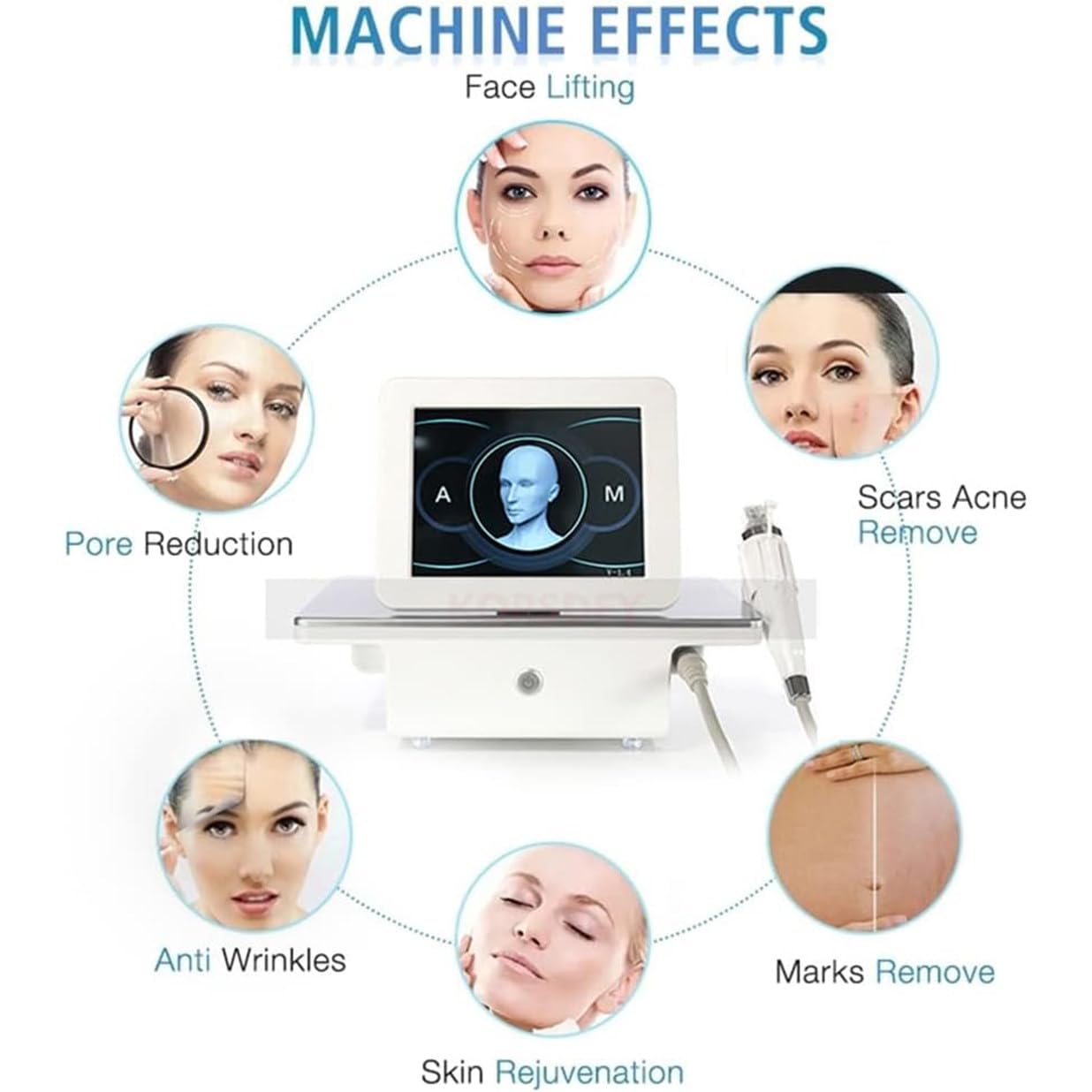 Fraktioniertes RF-Mikronadelgerät – Narben- & Dehnungsstreifenentfernung, Facelifting, Anti-Aging & Faltenentfernung