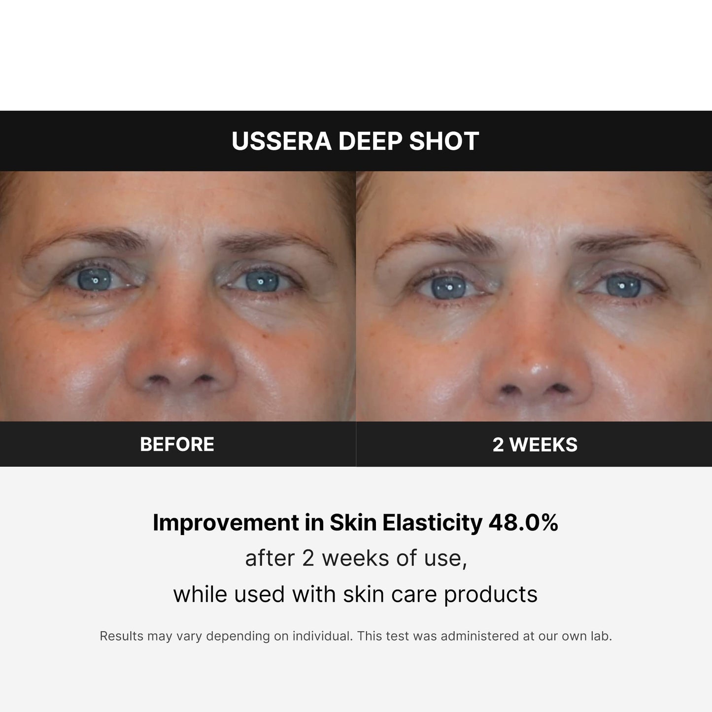 Medicube Age-R USSERA Facial Device – At-Home Skin Care for Collagen Stimulation, Wrinkle Reduction & Youthful Complexion – Korean Skincare