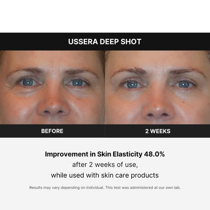 Medicube Age-R USSERA Facial Device – At-Home Skin Care for Collagen Stimulation, Wrinkle Reduction & Youthful Complexion – Korean Skincare