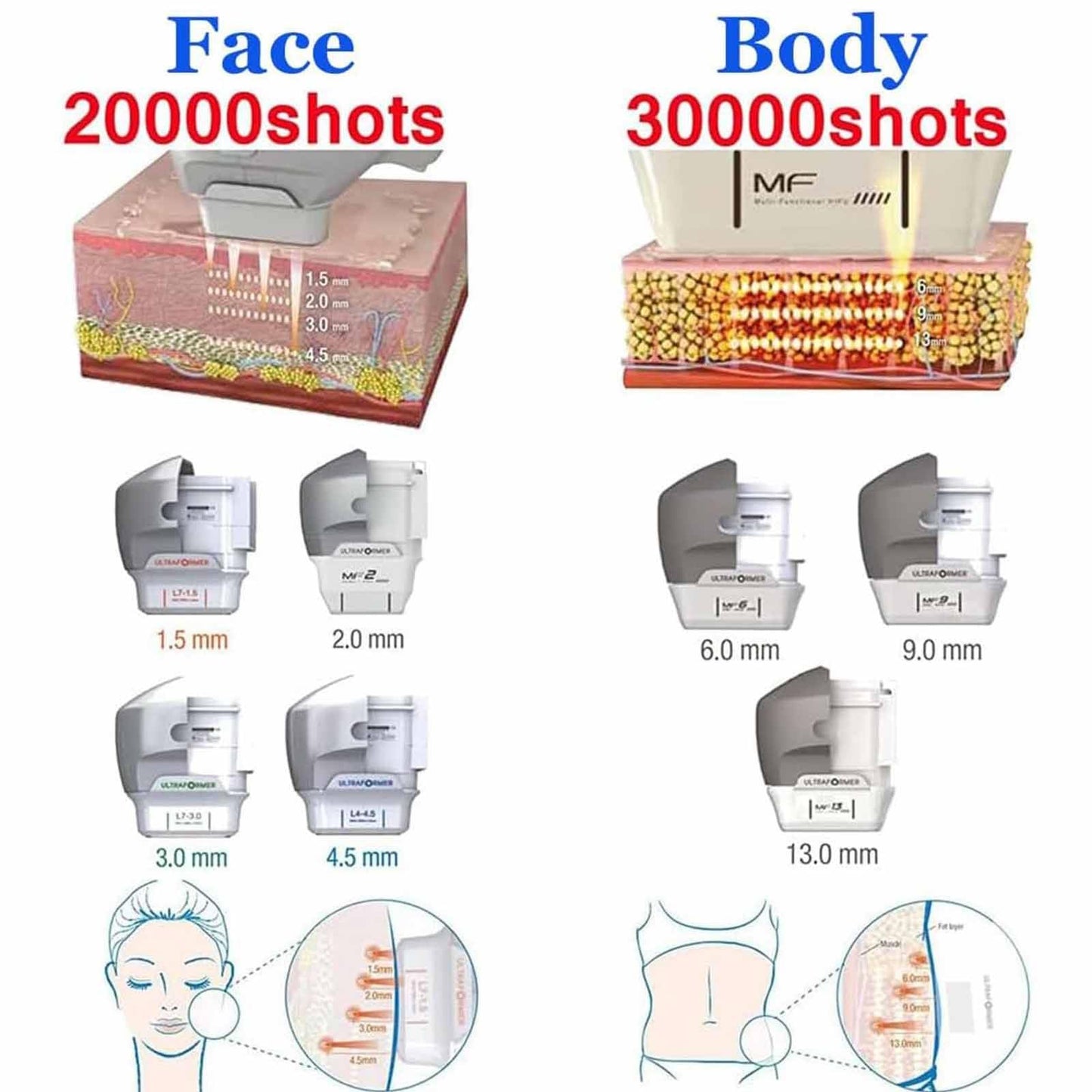 Professionelles 7-in-1 Hifu-Gerät für Gesicht & Körper – Tiefen 1,5–13 mm, MF2-Kartusche für feine Fältchen, nicht-invasiv, sicher, medizinisch