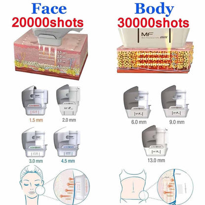Professionelles 7-in-1 Hifu-Gerät für Gesicht & Körper – Tiefen 1,5–13 mm, MF2-Kartusche für feine Fältchen, nicht-invasiv, sicher, medizinisch