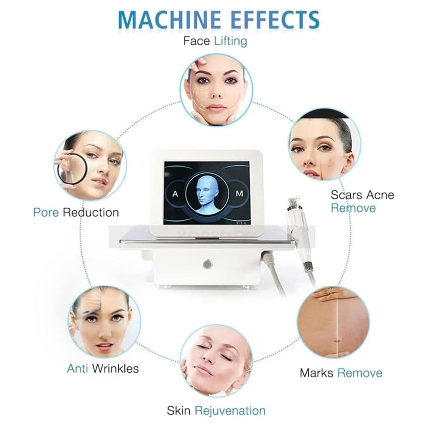 Fractional RF Microneedling Maschine zur Narben- & Dehnungsstreifenentfernung, Facelifting, Hautstraffung mit 2 Griffen – Anti-Aging