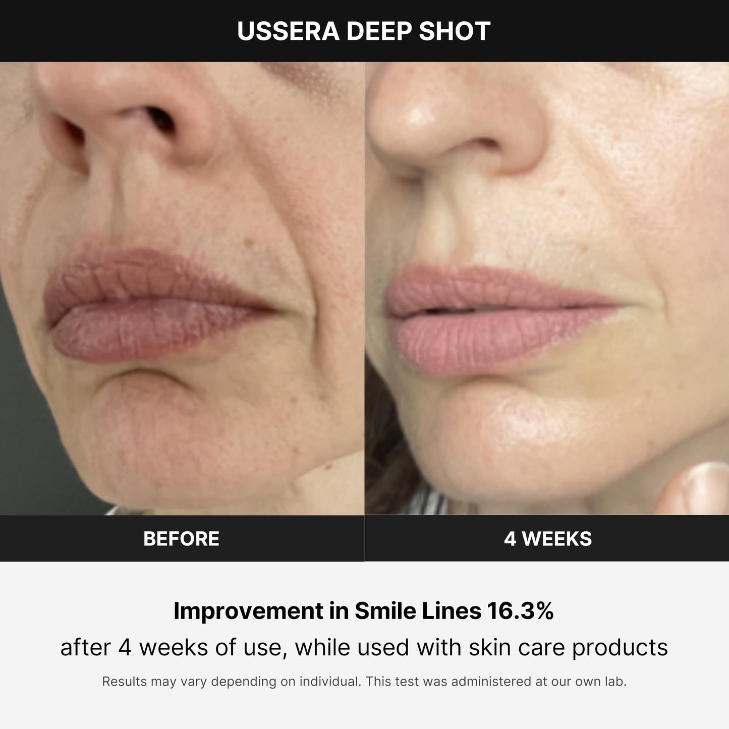 Medicube Age-R USSERA Facial Device – At-Home Skin Care for Collagen Stimulation, Wrinkle Reduction & Youthful Complexion – Korean Skincare