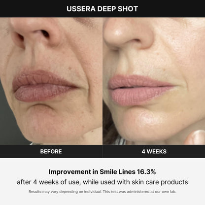 Medicube Age-R USSERA Facial Device – At-Home Skin Care for Collagen Stimulation, Wrinkle Reduction & Youthful Complexion – Korean Skincare