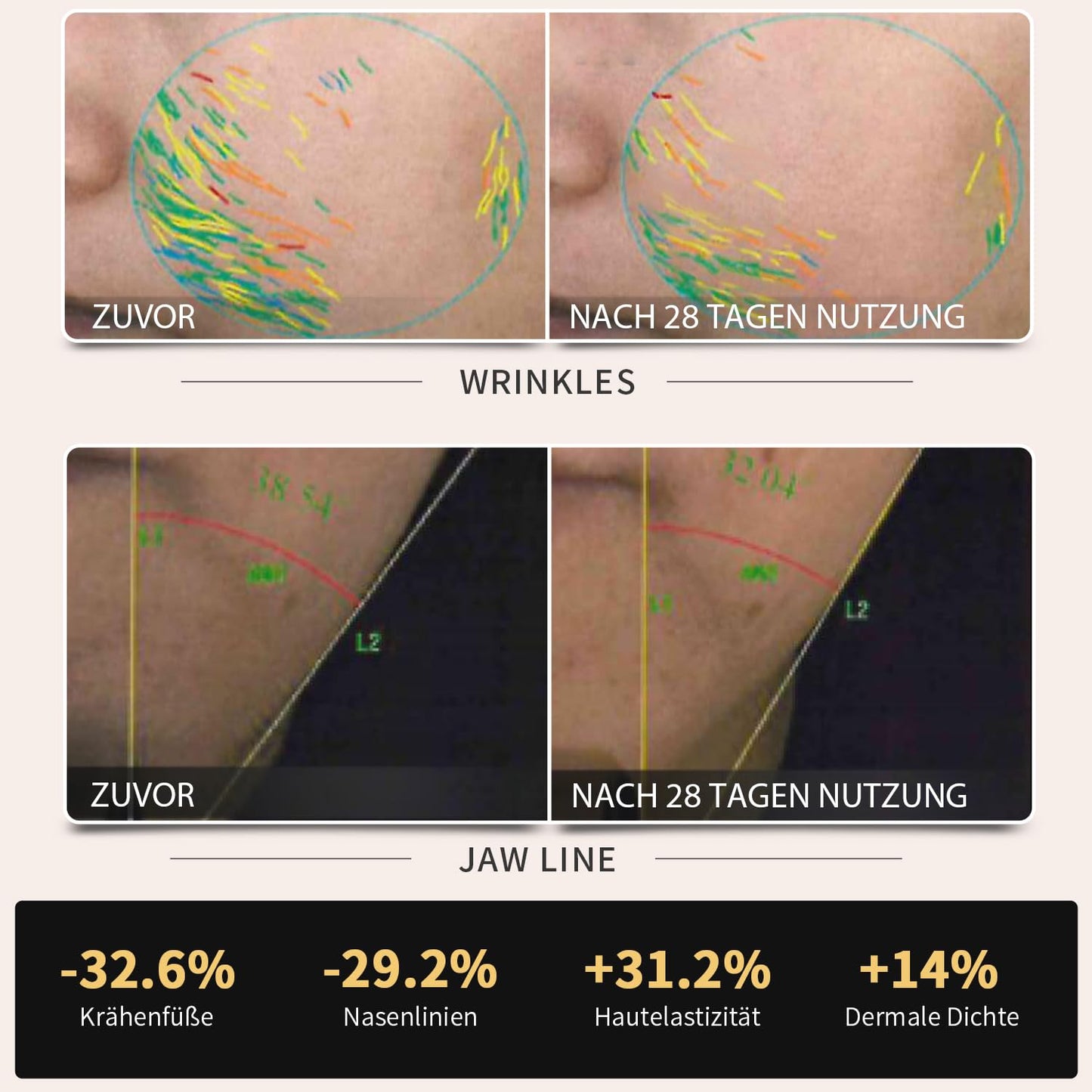 AMIRO R1 Pro RF Radiofrequenz Gesichtsgerät – Hautstraffung, Verjüngung, Mikrostrom Anti-Aging, Faltenentfernung, Professionell, Schwarz