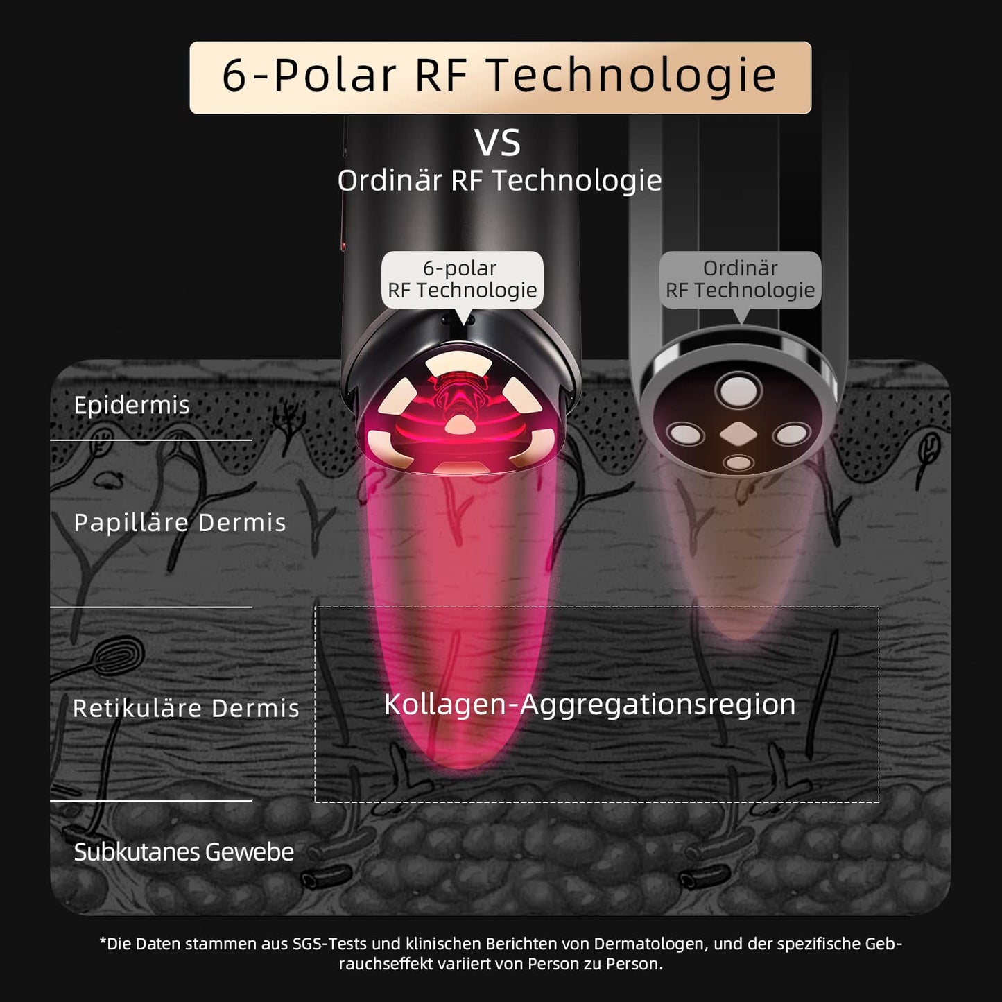 AMIRO R1 Pro RF Radiofrequenz Gesichtsgerät – Hautstraffung, Verjüngung, Mikrostrom Anti-Aging, Faltenentfernung, Professionell, Schwarz