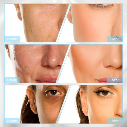 Elitzia 3-in-1 Sauerstoff-Blasen-Gesichtsmaschine mit CO2-Nano-Blasen, RF, Anti-Aging & Tiefenreinigung – Heimsalon ETL10