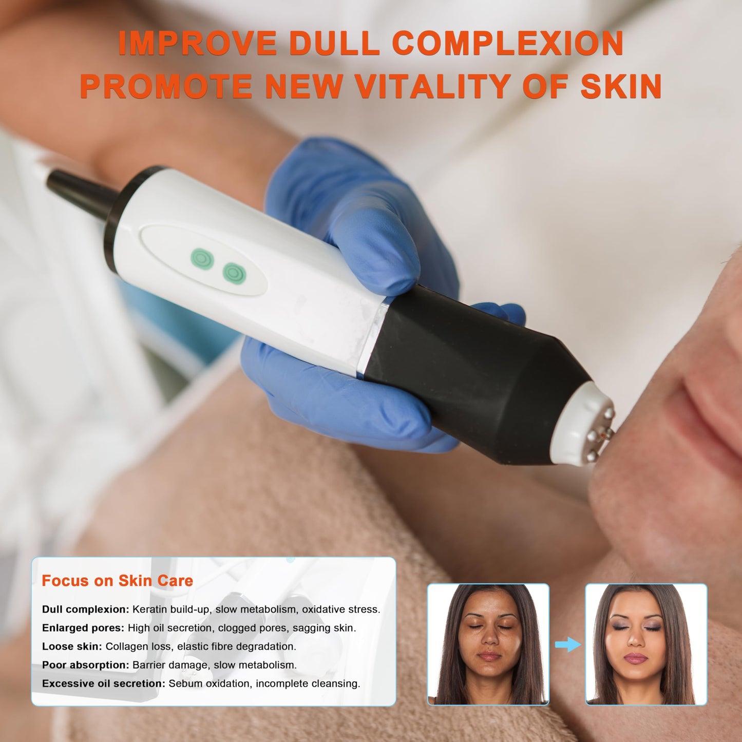 Elitzia 3-in-1 Sauerstoff-Blasen-Gesichtsmaschine mit CO2-Nano-Blasen, RF, Anti-Aging & Tiefenreinigung – Heimsalon ETL10