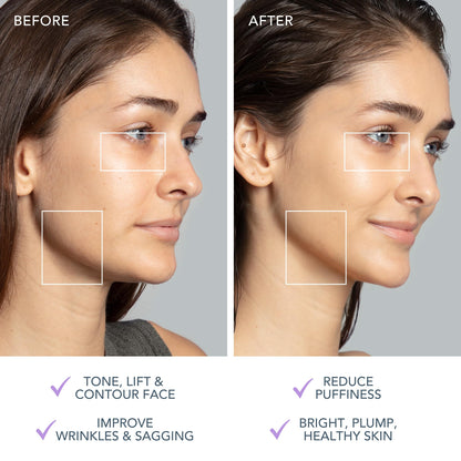 FOREO BEAR 2 Gesichtsmassagegerät mit Mikrostrom – Face Lifting, Toning, Anti-Aging, Straffung & Festigung, nicht-invasiv – Lavender